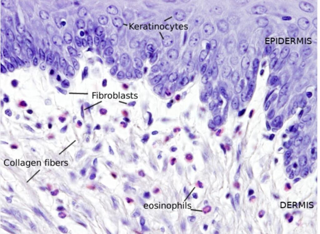 Fibroblastlar